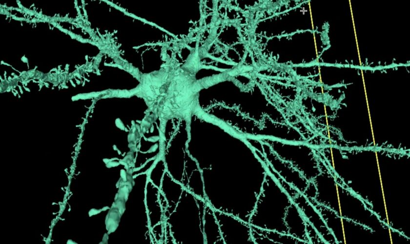 Detailliertes 3D-Modell: Wissenschaftlicher Durchbruch: So sieht das menschliche Gehirn tatsächlich aus