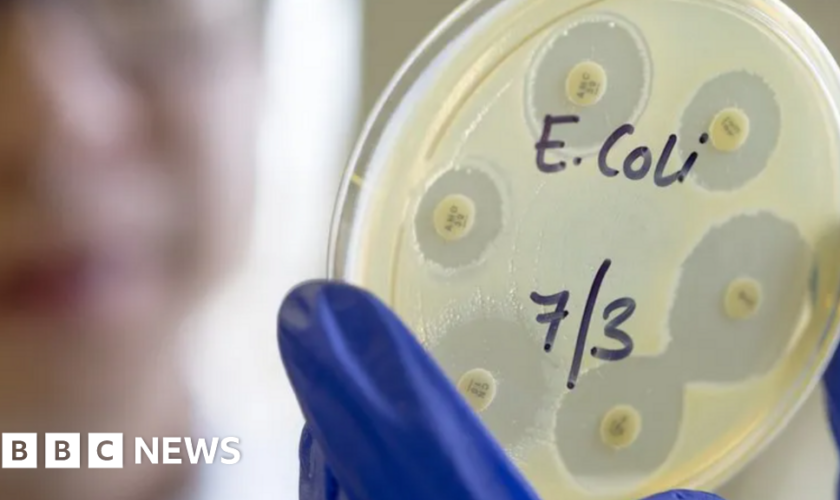 Person dies in UK E. coli outbreak linked to salad