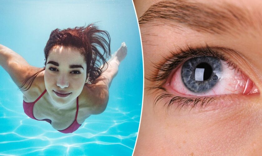 Ask a doctor: ‘Is it safe to swim underwater with my eyes open?’