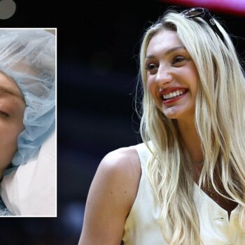 WNBA rookie Cameron Brink responds to fans saying she wore makeup post-ACL surgery