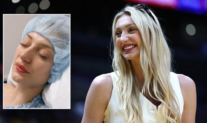 WNBA rookie Cameron Brink responds to fans saying she wore makeup post-ACL surgery