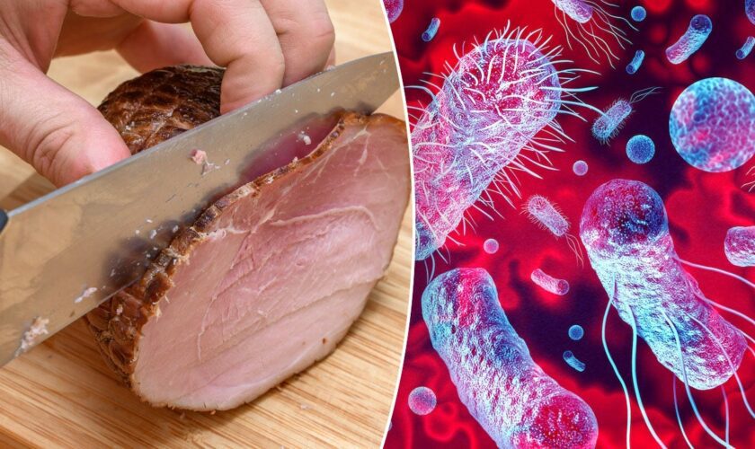 Listeria infection linked to deli meats kills 2, infects 28 across US, CDC warns