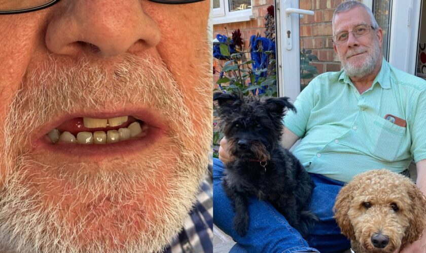 Patient’s huge payout after routine dental surgery could shorten his life by five years