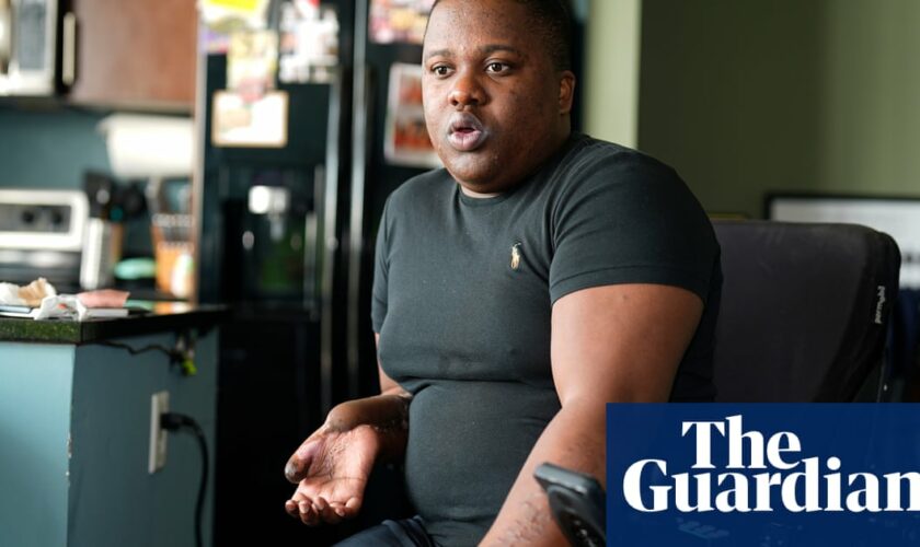 Former Denver police recruit sues over ‘barbaric’ training that cost him his legs