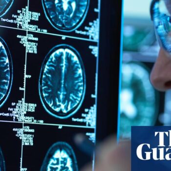 Record numbers of people in England given dementia diagnosis in past year