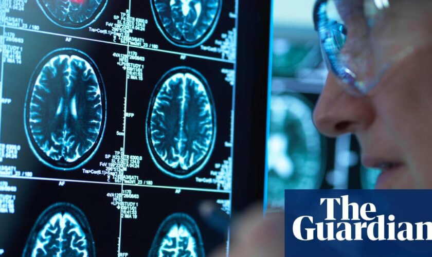 Record numbers of people in England given dementia diagnosis in past year