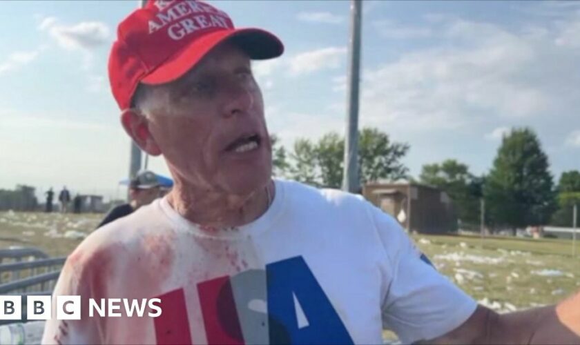 ‘I did CPR’ - doctor says he helped man shot at Trump rally