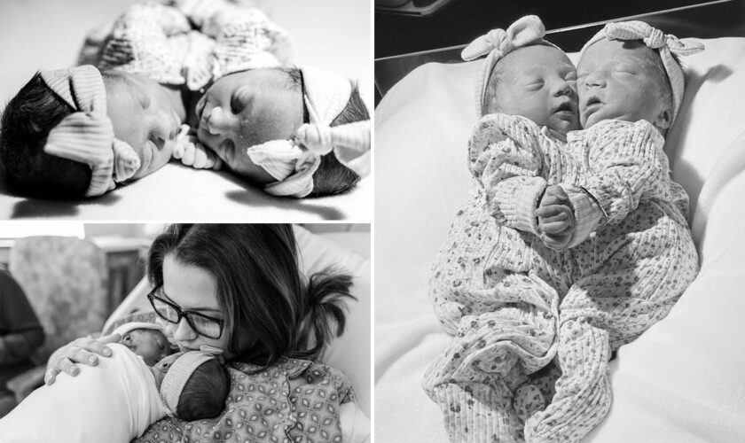 Atlanta couple’s conjoined twin daughters, fused at the heart, lived for just 1 hour: ‘Gift from God’