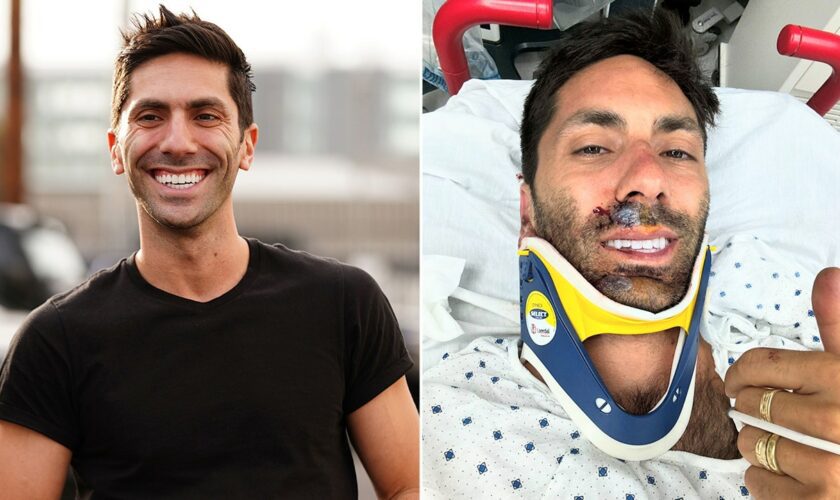 ‘Catfish’ host Nev Schulman ‘lucky to be here,’ revealing he broke his neck in bike accident