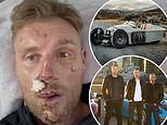 Freddie Flintoff reveals just how bad his horrific injuries were in new clip filmed a week after his crash - as he admits he'll never be the same again: 'I am really struggling and I need help. Genuinely shouldn't be here'