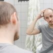 Cure for men's hair loss could be found in sugar stored in the body, study suggests