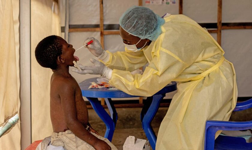 What is mpox and what does the WHO emergency declaration mean?