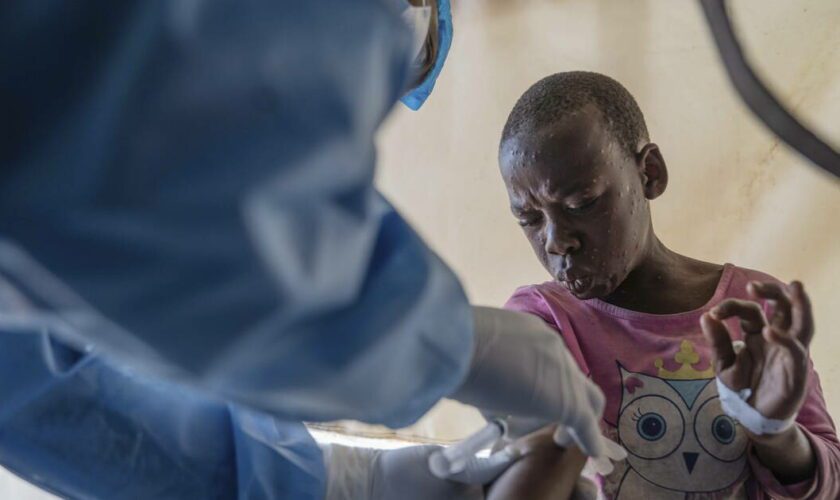 Mpox : l’Institut Pasteur prêt à «tester et vacciner» face à la recrudescence de l’épidémie