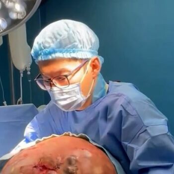 Moment doctors remove 30kg tumour from woman's stomach after months of mystery pain