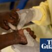 Africa CDC declares mpox outbreak a public health emergency