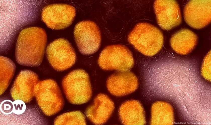 Faktencheck: Keine Verbindung zwischen Mpox und COVID-Impfung