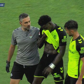 Mendy, a falta de pruebas tras abandonar el amistoso frente al Cádiz antes del descanso