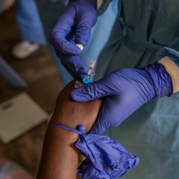 Mpox: Germany to give Africa 100,000 doses of vaccine