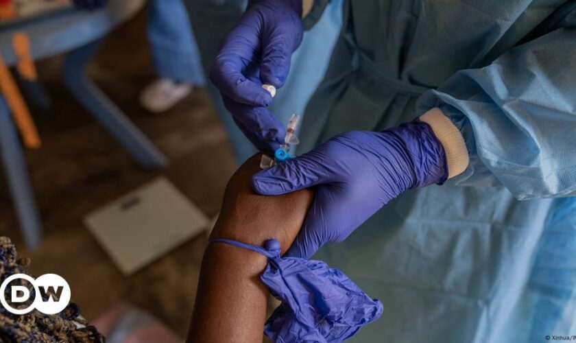 Mpox: Germany to give Africa 100,000 doses of vaccine