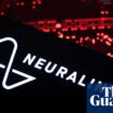 Neuralink has implanted second trial patient with brain chip, Elon Musk says