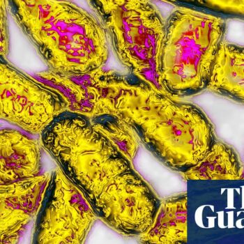 Second person dies after being diagnosed with legionnaires’ disease amid Melbourne outbreak