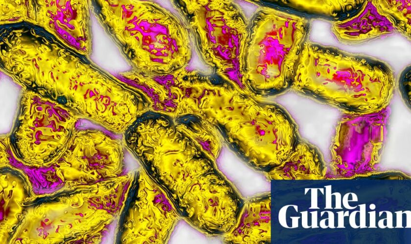 Second person dies after being diagnosed with legionnaires’ disease amid Melbourne outbreak