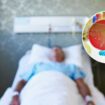 Sepsis a top killer in US behind heart disease, cancer: What to know, how to avoid the condition