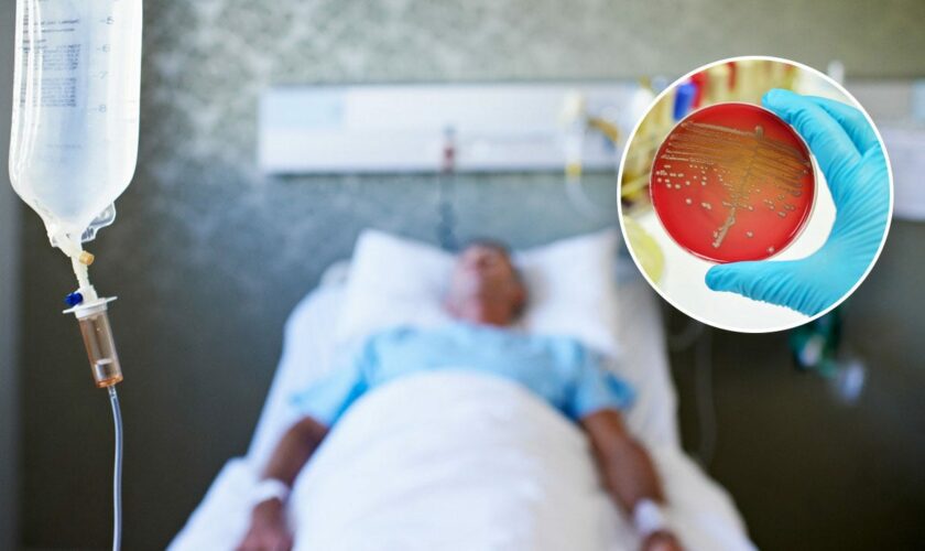 Sepsis a top killer in US behind heart disease, cancer: What to know, how to avoid the condition