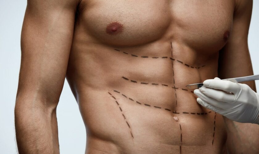 'Six-pack surgery' gaining popularity among men, say plastic surgeons