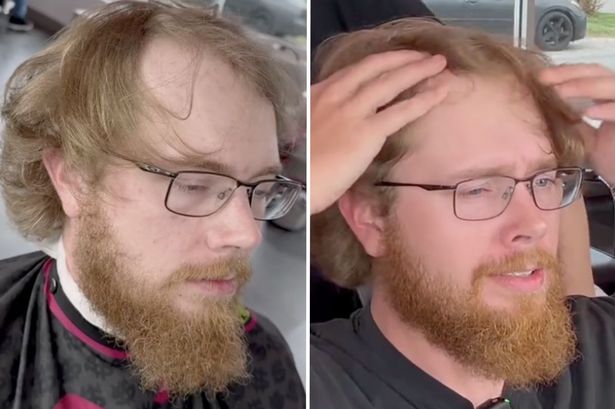 Man with receding hairline left unrecognisable after travelling two hours for trim