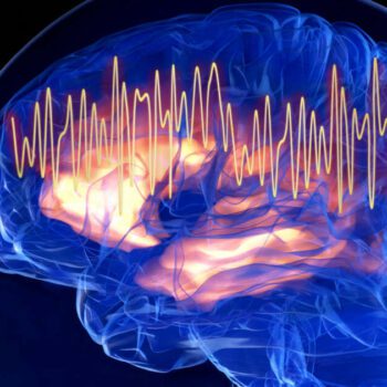 Une anomalie de l’activité cérébrale pourrait être un signe précurseur de la maladie d’Alzheimer