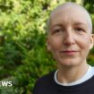 Hair loss, nosebleeds, and a Taylor Swift concert: How I coped with chemo