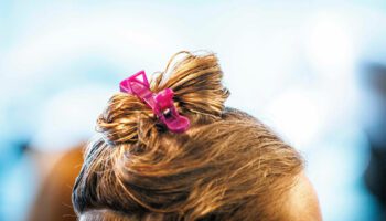 Les problèmes de vue d’une Française de 61 ans expliqués par l’utilisation de sa coloration pour cheveux