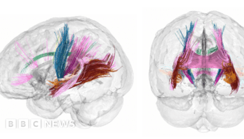 Pregnancy brain changes revealed in detailed scans