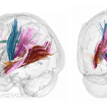 Pregnancy brain changes revealed in detailed scans