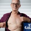 ‘I couldn’t believe it’: routine GP checkup reveals 2kg tumour growing in Brisbane man’s liver