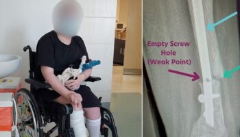 'We trusted our son's friendly surgeon - until he had to have his leg amputated due to his mistake'