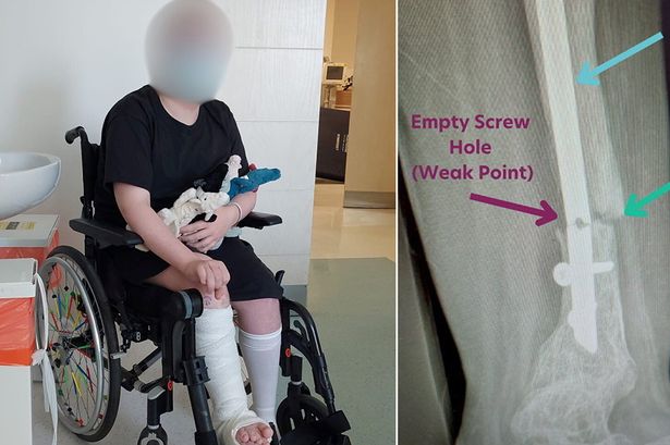 'We trusted our son's friendly surgeon - until he had to have his leg amputated due to his mistake'