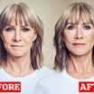 I aged overnight when I hit 60. Now I look and feel 10 years younger thanks to a dramatic treatment: Fashion designer KAREN MILLEN reveals her beauty secret