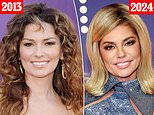 Plastic surgeons explain Shania Twain's 'unrecognizable' new look