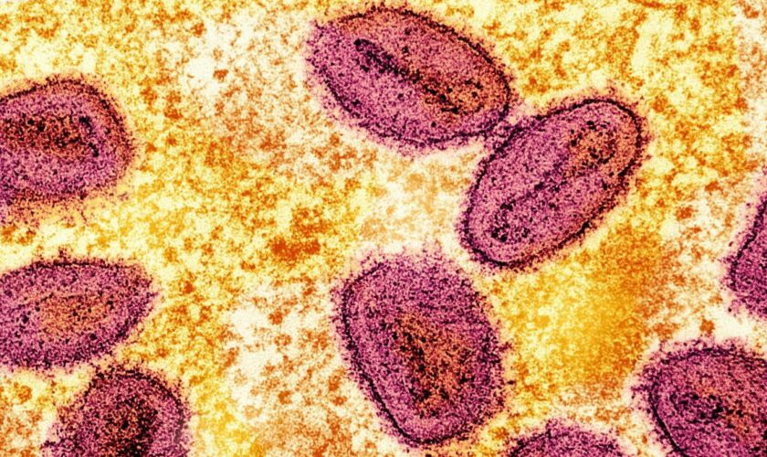 RKI meldet ersten Nachweis von neuer Mpox-Variante in Deutschland