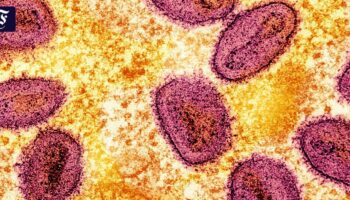 Erster Fall neuer Mpox-Variante in Deutschland