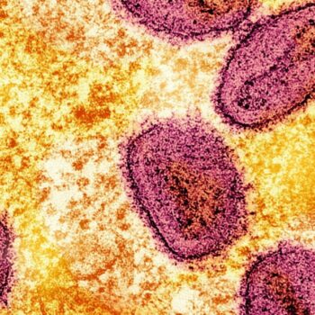 Erster Fall neuer Mpox-Variante in Deutschland