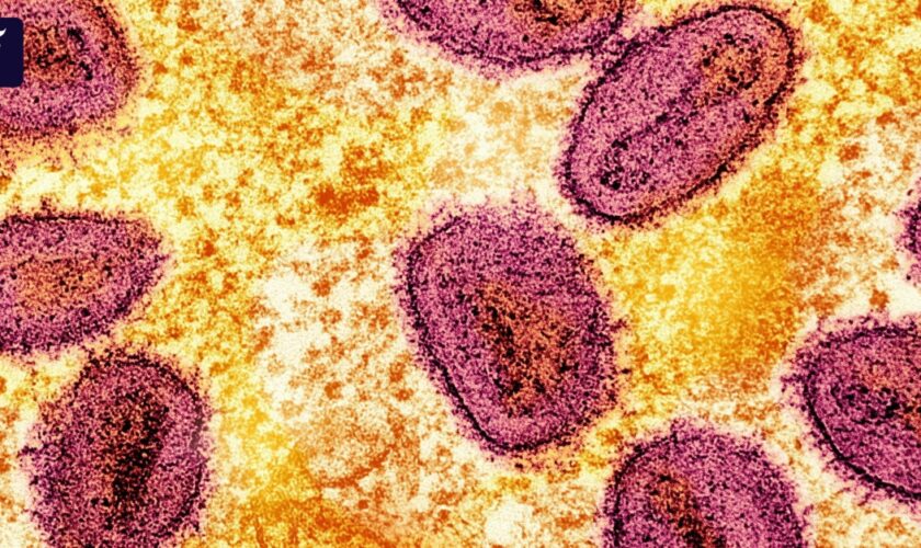 Erster Fall neuer Mpox-Variante in Deutschland