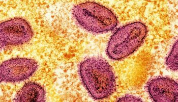 Erster Nachweis von neuer Mpox-Variante in Deutschland