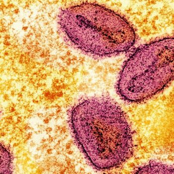 Erster Nachweis von neuer Mpox-Variante in Deutschland