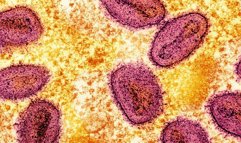 Mpox: Erster Fall neuer Mpox-Variante in Deutschland gemeldet