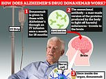 Anger as NHS patients told they WON'T get 'new hope' Alzheimer's drug donanemab