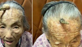 Woman, 107, credits 10cm horn growing out of her forehead with granting her long life