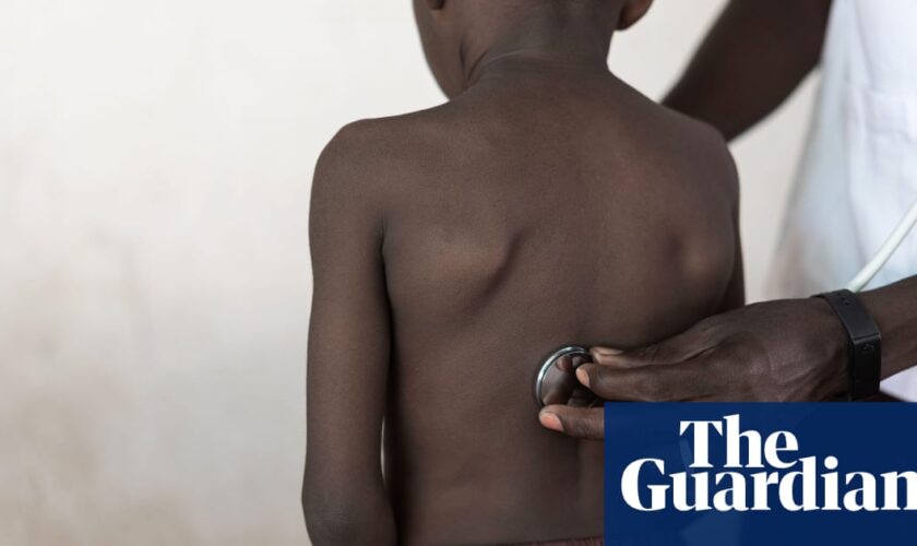 Millions of teenagers in Africa have undiagnosed asthma – study